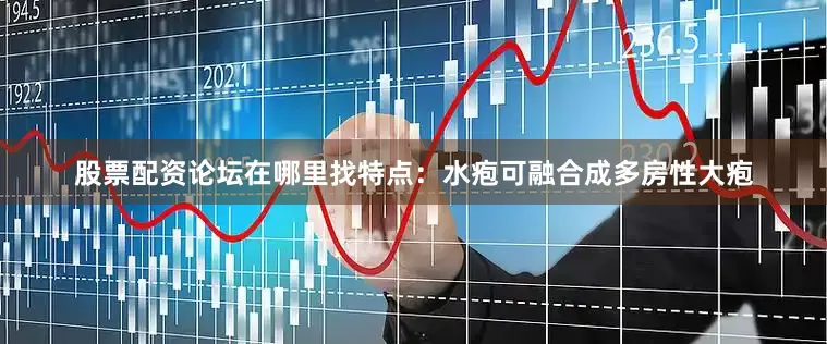 股票配资论坛在哪里找特点：水疱可融合成多房性大疱